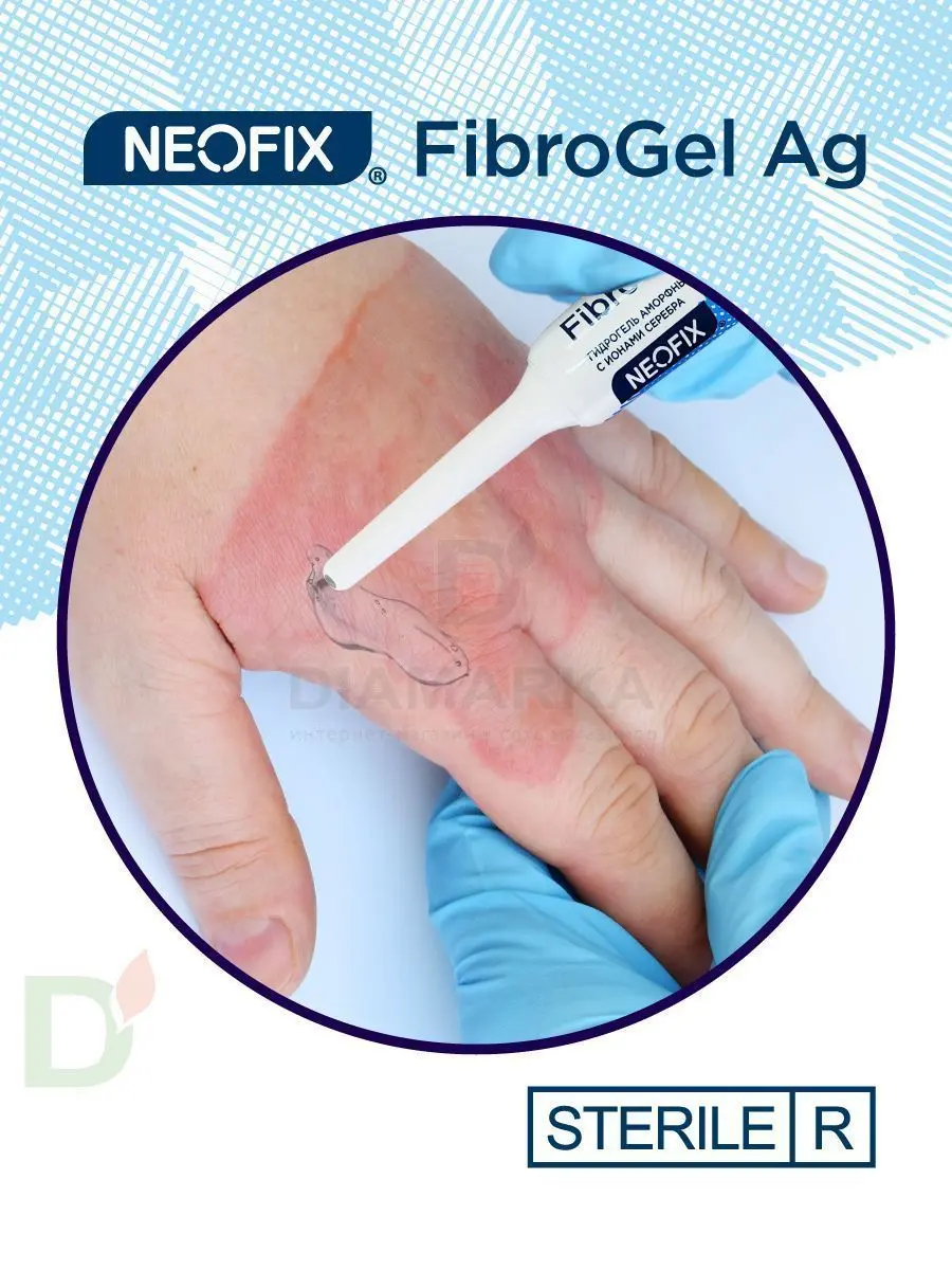 Гидрогель антимикробный NEOFIX FibroGel Fg с ионами серебра 15г в Саратове