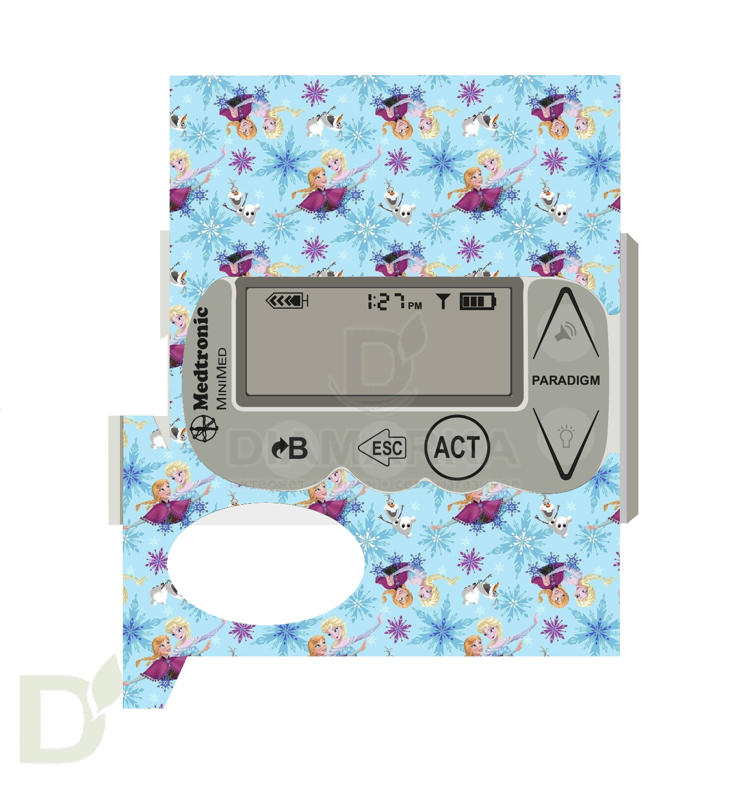 Наклейка на помпу Medtronic моделей 715, 722, 754