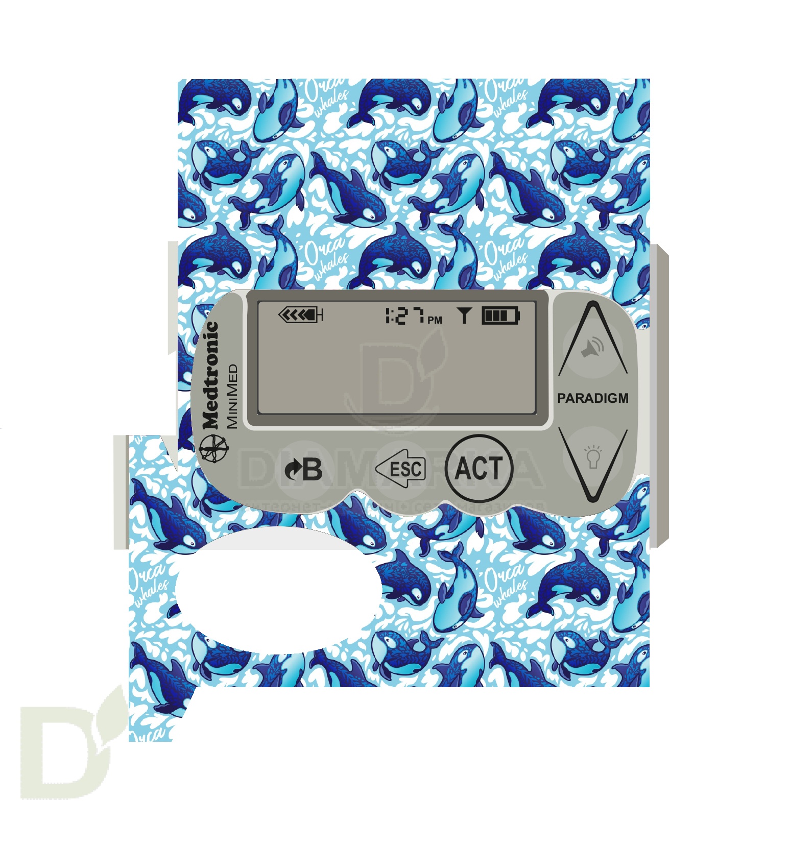 Наклейка на помпу Medtronic моделей 715, 722, 754